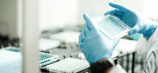 華中農(nóng)業(yè)大學(xué)New Phytologist解析番茄類胡蘿卜素調(diào)控