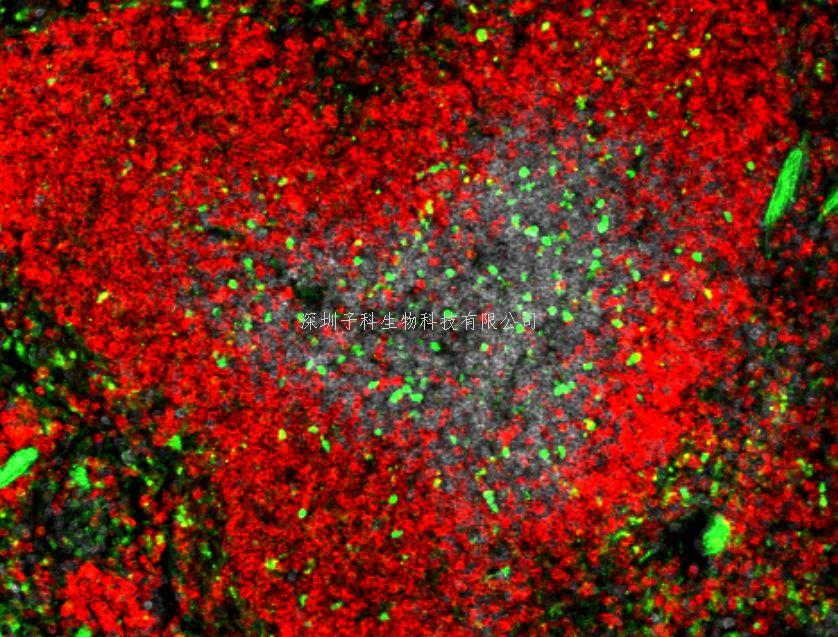 清華大學(xué)醫(yī)學(xué)院祁海教授Immunity揭示體液免疫反應(yīng)調(diào)控新機(jī)制