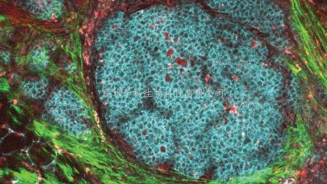 山東大學(xué)，清華大學(xué)等Science子刊發(fā)文：氨基酸缺乏與新型病毒性疾病