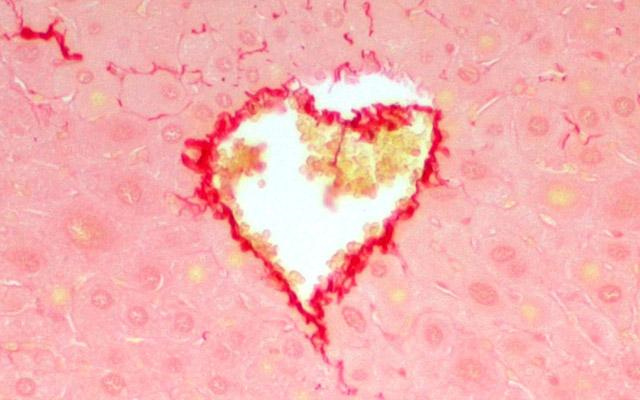 Cell：Caspase-2酶抑制劑可以改善脂肪肝疾病