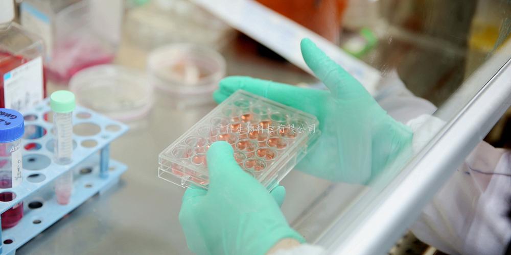 人食管癌細(xì)胞；Eca-109 [Eca109]