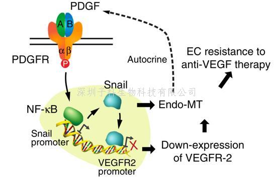 中大學(xué)者Nature子刊發(fā)文：腦膠質(zhì)母細(xì)胞瘤作用機(jī)制新發(fā)現(xiàn)