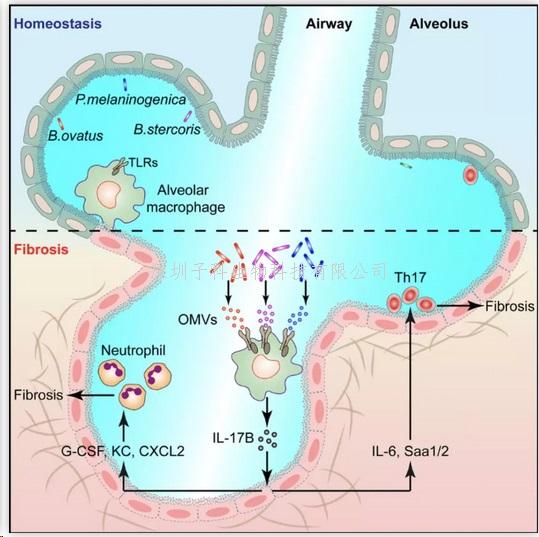 Immunity：錢友存團隊發(fā)現(xiàn)肺纖維化疾病的分子機制