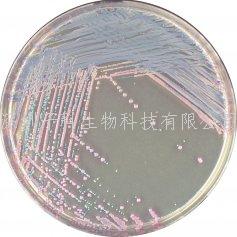 科馬嘉KPC顯色培養(yǎng)基