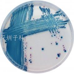 科瑪嘉產(chǎn)志賀毒素大腸桿菌STEC培養(yǎng)基