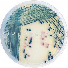 科馬嘉小腸結(jié)腸炎耶爾森氏菌顯色培養(yǎng)基