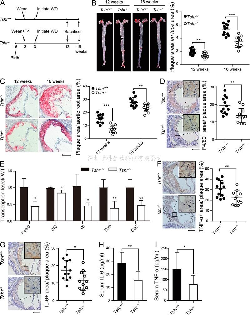 山大學(xué)者解析促甲狀腺激素如何促成動脈粥樣硬化