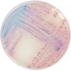小鼠冠狀病毒抗體（coronaviruses-ab）試劑盒