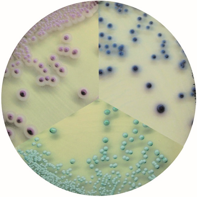 念珠菌顯色培養(yǎng)基