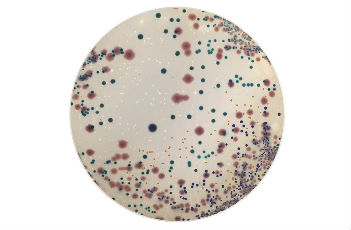 尿路感染顯色培養(yǎng)基（UTIC）