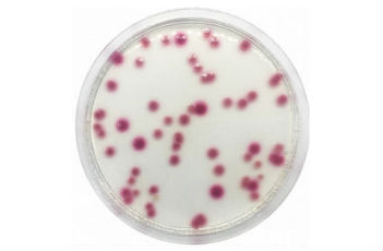 克雷伯菌顯色培養(yǎng)基