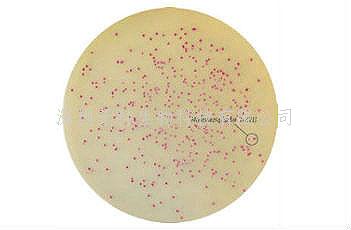 印度HiMedia 馬拉色菌顯色培養(yǎng)基