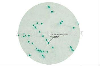 印度HiMedia 梭菌顯色培養(yǎng)基