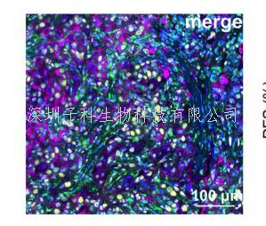 腫瘤醫(yī)院周光飚教授團(tuán)隊(duì)在腫瘤免疫療法療效預(yù)測上取得新進(jìn)展