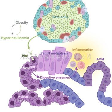 Cell子刊：首次指出胰腺腺泡細(xì)胞與胰島素水平升高有關(guān)