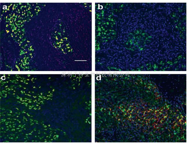 鼻咽癌免疫逃逸新機(jī)制：miR-155通過抑制ICOSL和MHC-I表達(dá)