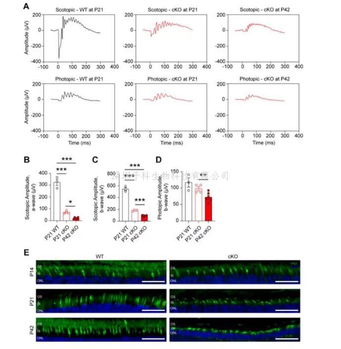 eLife：科學(xué)家揭示光感受器細(xì)胞中谷氨酰胺代謝對(duì)視網(wǎng)膜健康的決定性作用