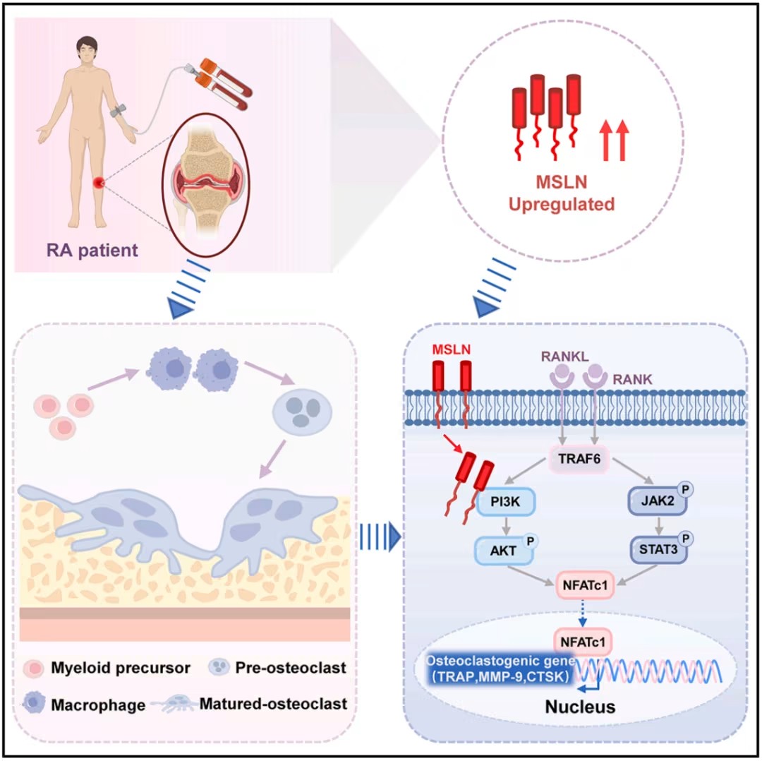 Cell子刊：孔祥英/魯超團(tuán)隊(duì)發(fā)現(xiàn)類風(fēng)濕性關(guān)節(jié)炎治療新靶點(diǎn)